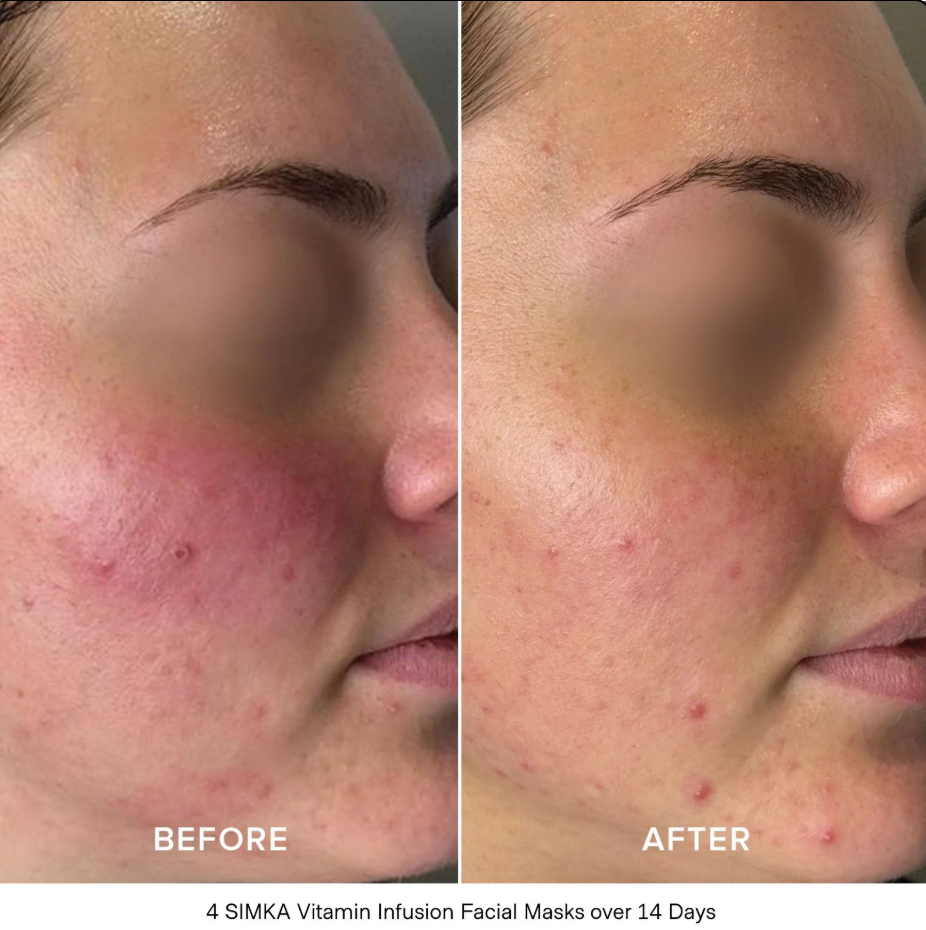 SIMKA Vitamin Infusion Bio-Cellulose Facial Mask