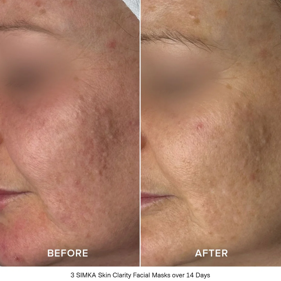 SIMKA Skin Clarity Bio-Cellulose Facial Mask (4 Pack)